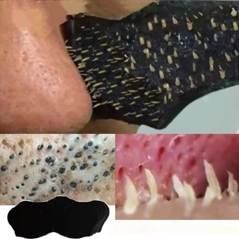 Unisex Blackhead Remove Mask N - Skincare Finally Found You recension och pris