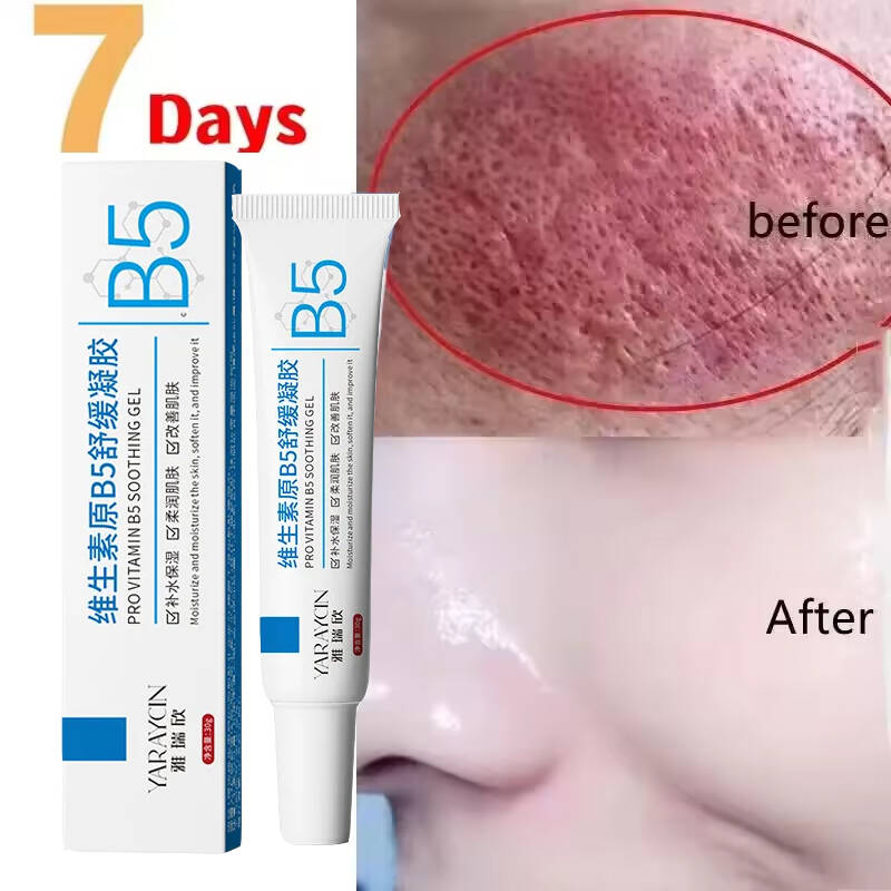 Facial Redness Repair Cream Im - Coenzyme Q10 Cream recension och pris