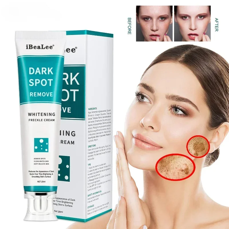 Whitening Freckle Cream Remove - Skincare Glowing recension och pris