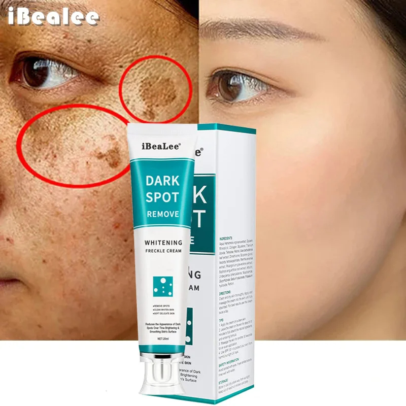 Whitening Freckle Cream Remove - Skincare Glowing recension och pris