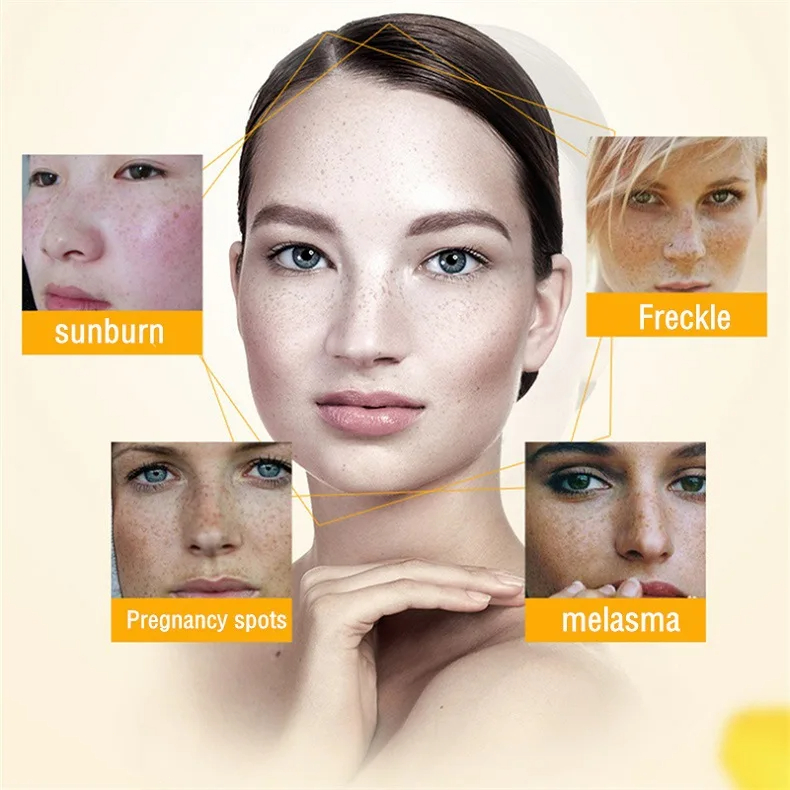 Whitening Freckle Cream Remove - Skincare Glowing recension och pris