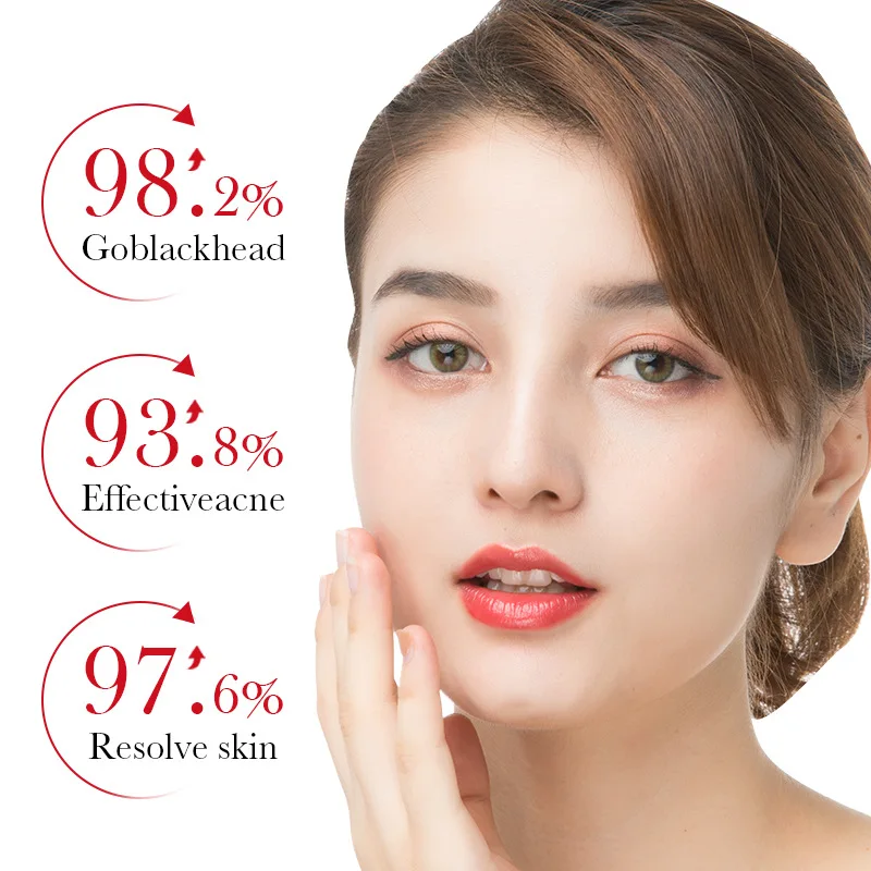 BIOAQUA Salicylic Acid Acne Re - Azelaic Acid Serum recension och pris