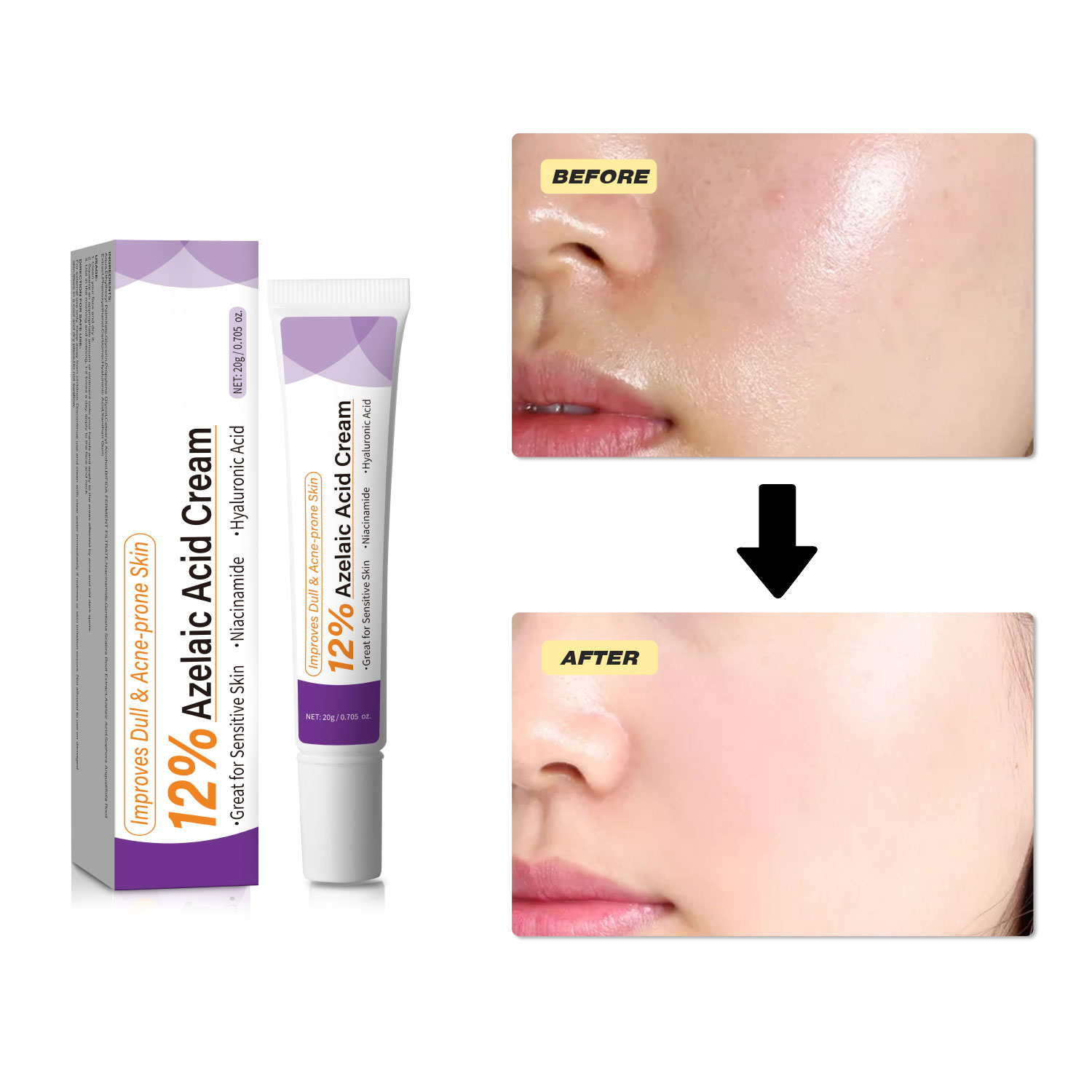 Mild Azelaic Acid Cream Improv - Azelaic Acid Serum recension och pris